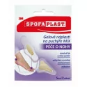 3M SPOFAPLAST Gélové náplasti na pľuzgiere mix veľkostí a tvarov 5 ks