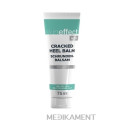 Skineffect Balzam na popraskané päty 25% Urea 75 ml