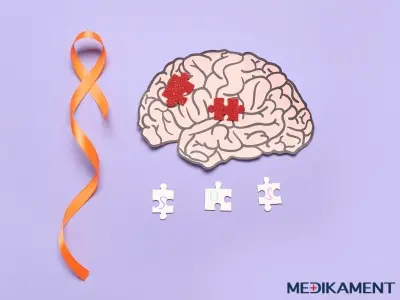 Aké sú príznaky a prejavy sklerózy multiplex a ako s ňou žiť?