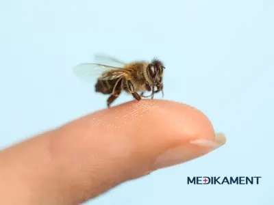 Čo pomôže na opuch po uštipnutí včelou alebo osou?