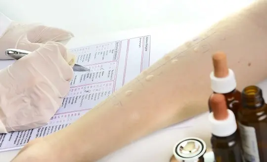 Ako na ľahší život s histamínovou intoleranciou | MEDIKAMENT