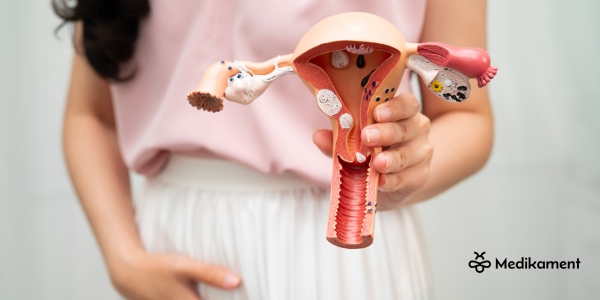 žľazov&aacute; hyperpl&aacute;zia endometria 